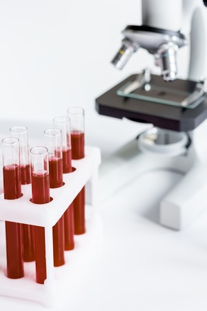 blood in glass tubes on background of microscopeの写真素材