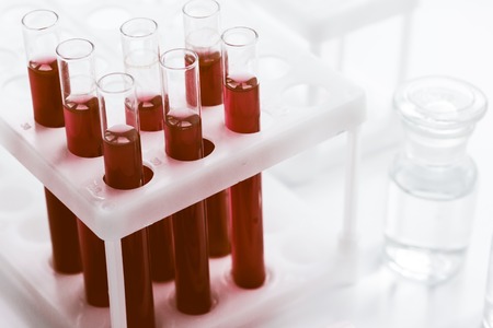 glass tubes with blood sample in stand no oneの写真素材