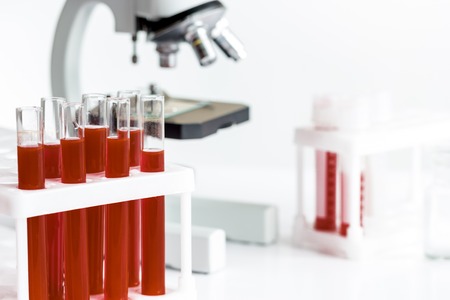 blood in glass tubes on background of microscope in the laboratoryの写真素材