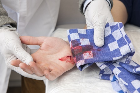 Doctor, examining a severe bleeding cut in the palm of a patient's handの写真素材