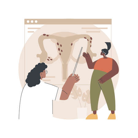Endometriosis abstract concept vector illustration.のイラスト素材