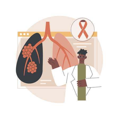 Lung cancer abstract concept vector illustration.のイラスト素材
