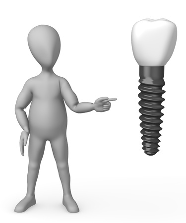 tooth implant with cartoon characterの写真素材