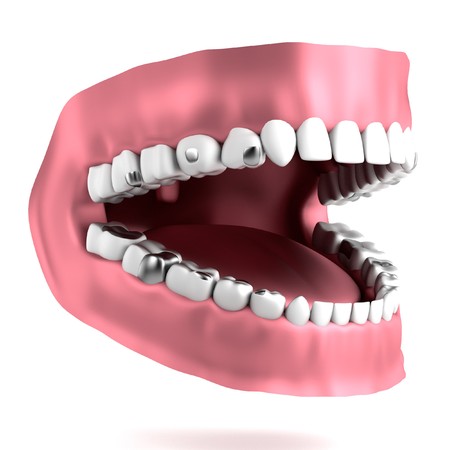 realistic 3d render of human teeth with fillings