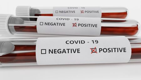 Realistic 3D Render of Test Tubes - Covid-19 Testの写真素材