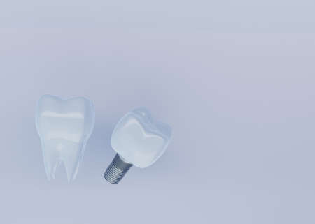 Tooth Crown and Dental Implant on gray background with copy space, dental implantation, artificial tooth, 3d renderの写真素材