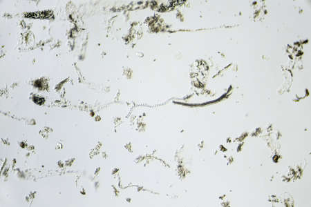 Spirochete, spiral bateria in the center of the photo. Sample taken from the gastrointestinal tract...