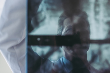 Experienced senior doctor in clinic is examining the X-ray image. Roentgenの写真素材