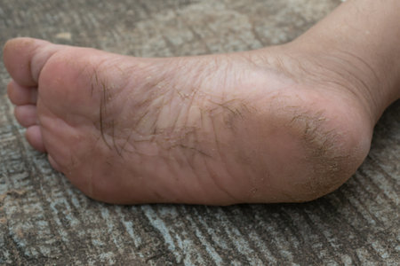 Close-up of human feet with dry skin on wooden background.の写真素材