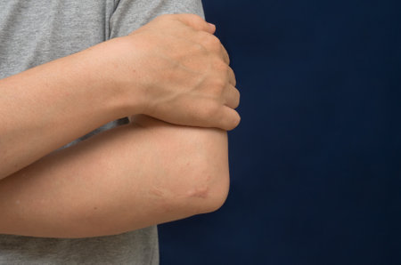 Man suffering from pain in elbow, closeup. Health care concept