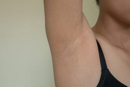 Woman scratching her armpit. Skin problem, health care conceptの写真素材