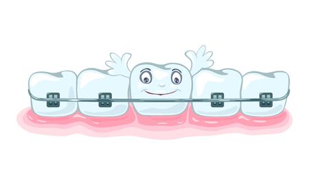 Using of metallic dental braces, orthodontic brackets to correct occlusion, alignment of dentition. Happy healthy beautiful teeth are in gum. Vector cartoon illustration isolated on white background.のイラスト素材