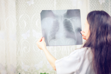 Doctor having conversation with his patient and holding xray in medical office