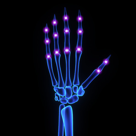 Finger jointsの写真素材