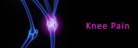 Knee painの写真素材