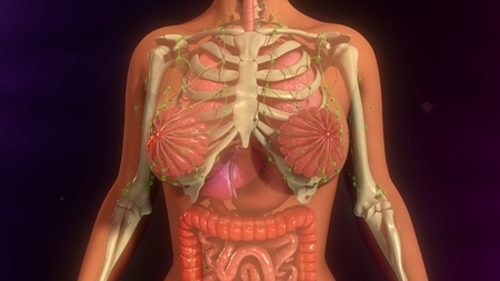 Metastasis Infectionの写真素材