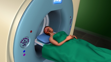 MRI Scanningの写真素材