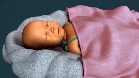 Jaundice in the new bornの写真素材