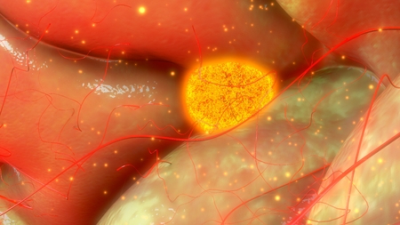 Ovarian folliclesの写真素材