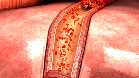 Blood flow in vesselsの写真素材