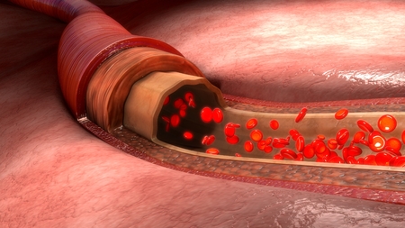 Blood flow in vesselsの写真素材