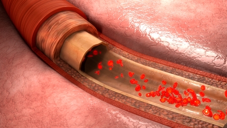 Blood flow in vesselsの写真素材