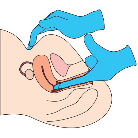 Gynecology posterのイラスト素材