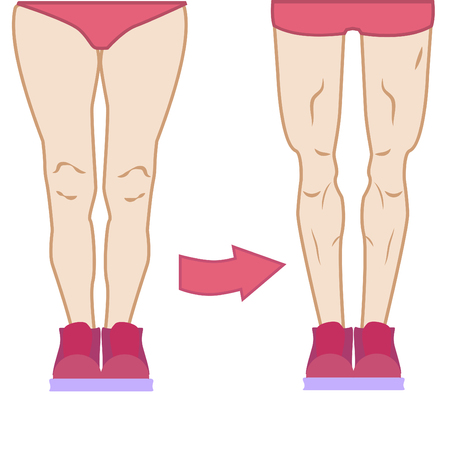 Legs workout challenge, different types body, tights fat and muscles, love your body in different conditionのイラスト素材
