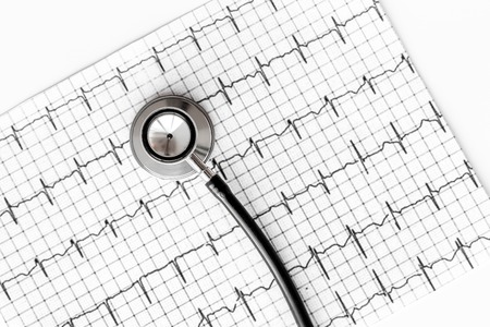Examine the heart to prevent heart disease. Cardiogram, stethoscope on white background top viewの写真素材