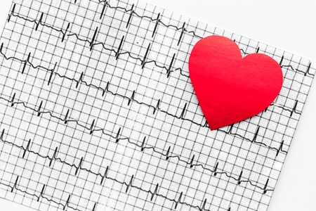 Examine the heart to prevent heart disease. Heart sign and cardiogram on white background top viewの写真素材