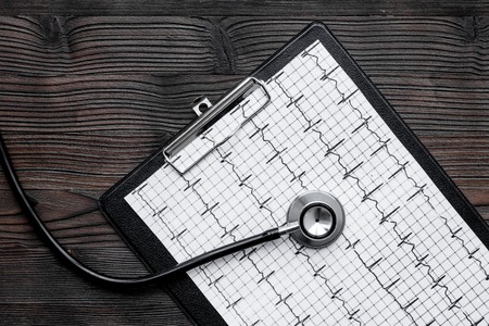 To diagnose heart disease. Cardiogram, stethoscope on white background top viewの写真素材