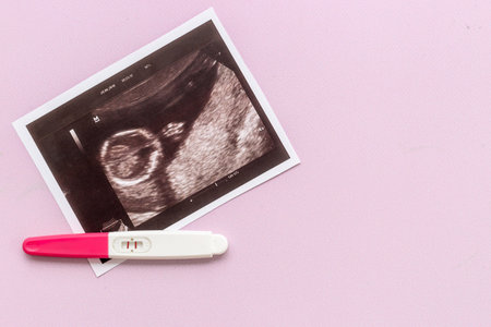 Positive pregnancy test with ultrasound picture of unborn baby
