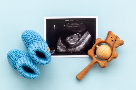Pregnancy background. Baby accessories with ultrasound picture of unborn baby