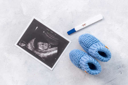 Pregnancy background. Baby accessories with ultrasound picture of unborn babyの写真素材