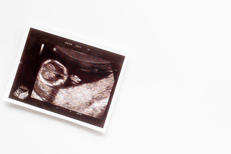 Pregnancy background with ultrasound picture of unborn baby
