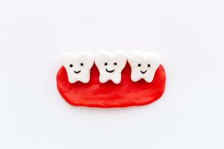Teeth models with caries or plaque on gums. Oral health conceptの写真素材