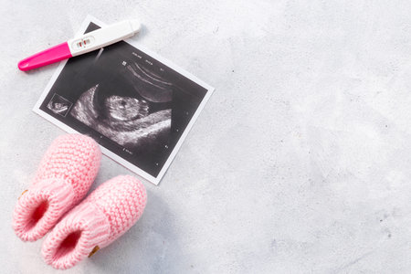 Ultrasound picture of unborn baby - pregnancy concept