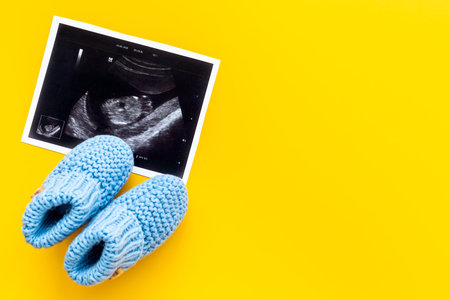 Newborn booties and prenatal ultrasound screening of unborn baby
