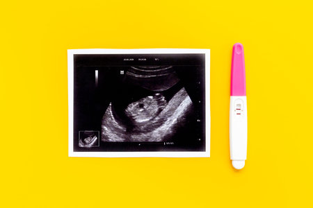 Prenatal ultrasound screening of unborn baby. Pregnancy background