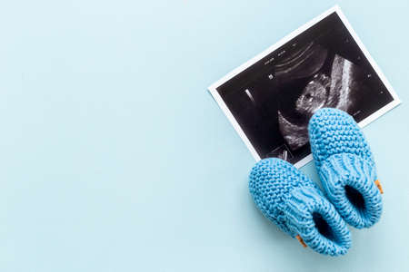Ultrasound picture of unborn baby - pregnancy conceptの写真素材