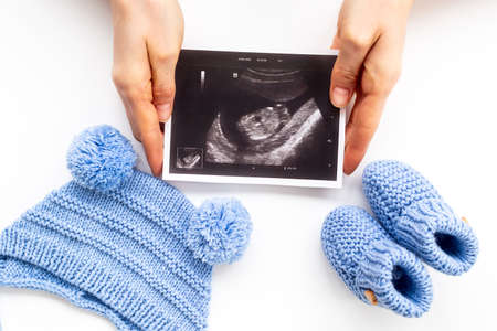 Pregnancy background. Baby accessories with ultrasound picture of unborn babyの写真素材