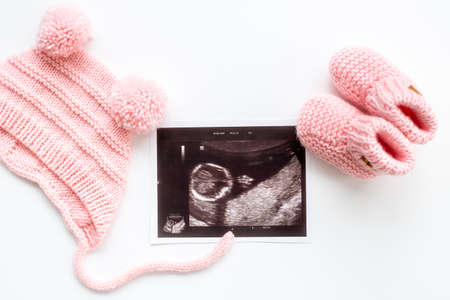 Sonography pregnancy picture of embryo with baby bootiesの写真素材