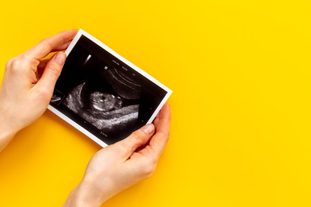 Ultrasound picture of unborn baby - pregnancy concept