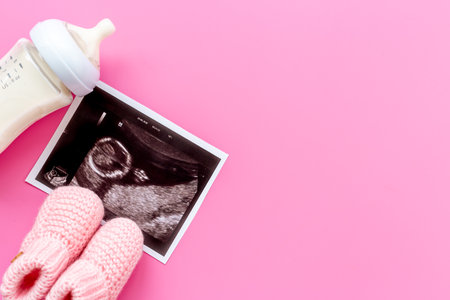 Ultrasound picture of unborn baby - pregnancy conceptの写真素材