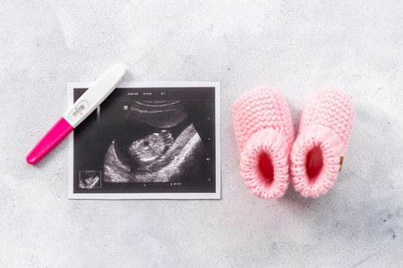 Newborn booties and prenatal ultrasound screening of unborn babyの写真素材