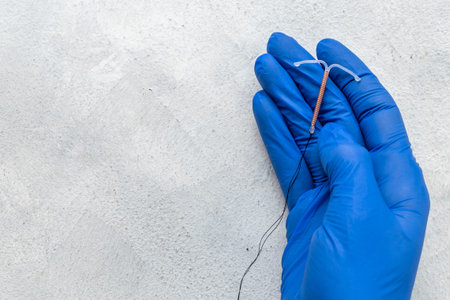 T-shaped intrauterine contraceptive device in gynecologist handの写真素材