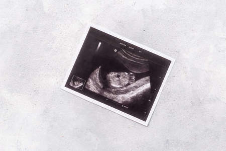 Pregnancy background with ultrasound picture of unborn babyの写真素材