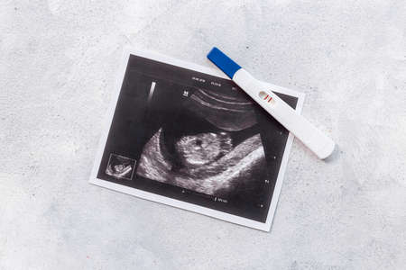 Prenatal ultrasound screening of unborn baby. Pregnancy backgroundの写真素材