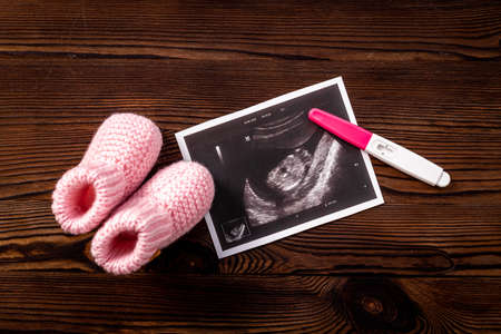 Ultrasound picture of unborn baby - pregnancy conceptの写真素材