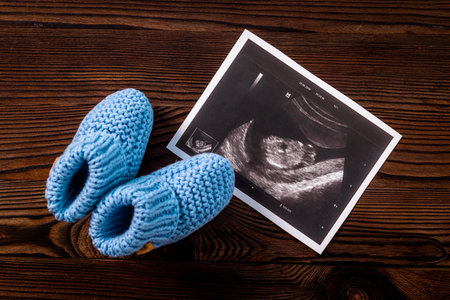 Newborn booties and prenatal ultrasound screening of unborn babyの写真素材